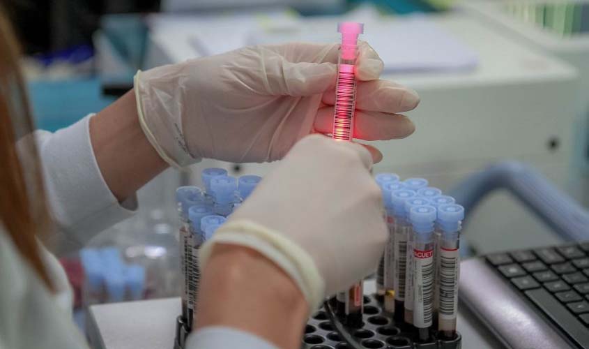 Boletim diário sobre o coronavírus em Rondônia