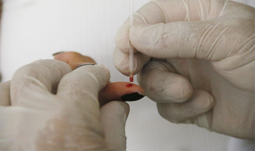 Novos equipamentos vão dar celeridade aos processos de avaliação do direito à insalubridade de servidores estaduais