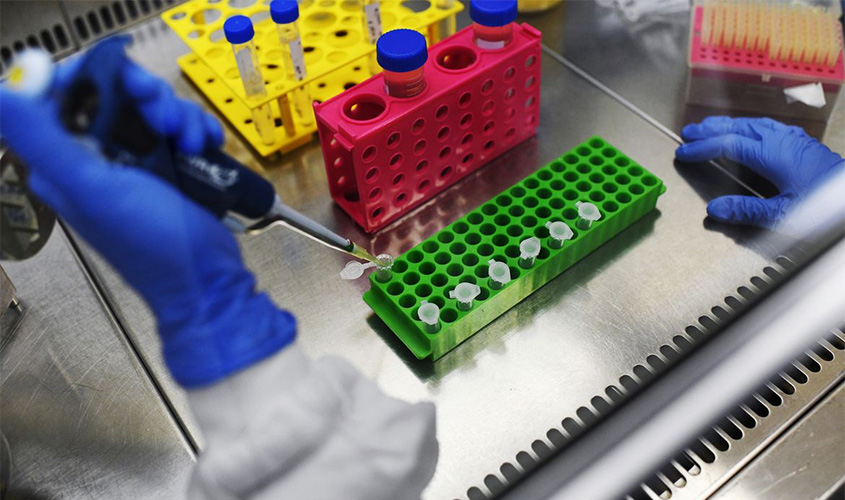 Número de mortes pelo novo coronavírus no Brasil chega a 159