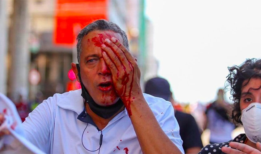 Homem alvejado pela PM no Recife perdeu o olho e não participava das manifestações 'Fora Bolsonaro'