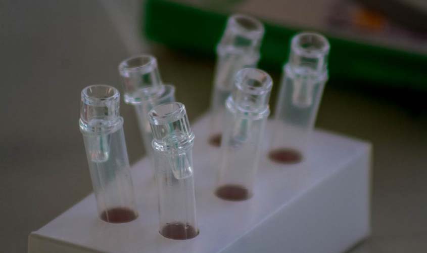 Sesau orienta onde buscar diagnóstico e tratamento para HIV/Aids na rede pública de saúde