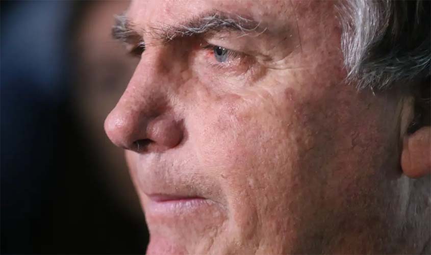 Com crise de soluços, Bolsonaro passa por nova cirurgia